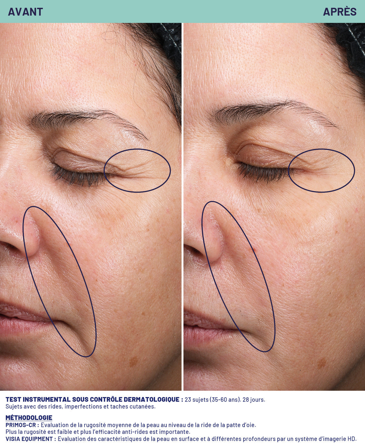 Double-action smoothing mask